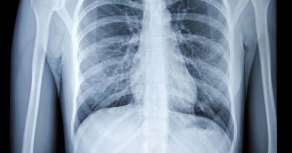 Todo lo que deben saber los pacientes sobre los rayos X